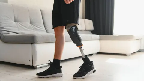 Prosthetic Limb Guide: Types, Mobility Technology, and Rehabilitation Information