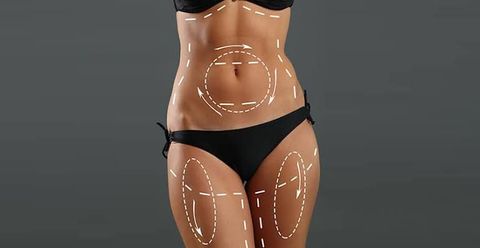 Cosmetic Surgery Planning Guide: Procedure Options, Consultation, and Recovery Information