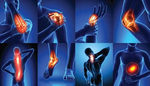 Joint Pain Treatment Guide: Medical Approaches, Physical Therapy, Medication Options, and Care Planning
